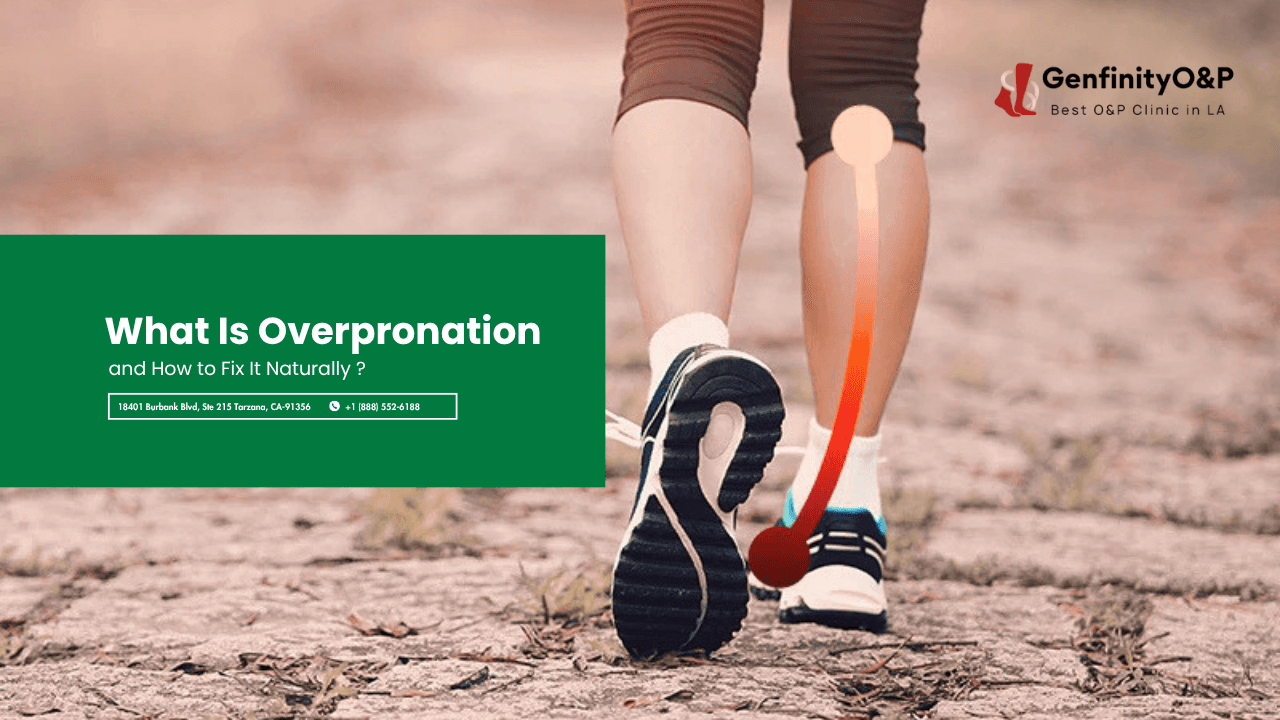 What Is Overpronation and How to Fix It Naturally ?
