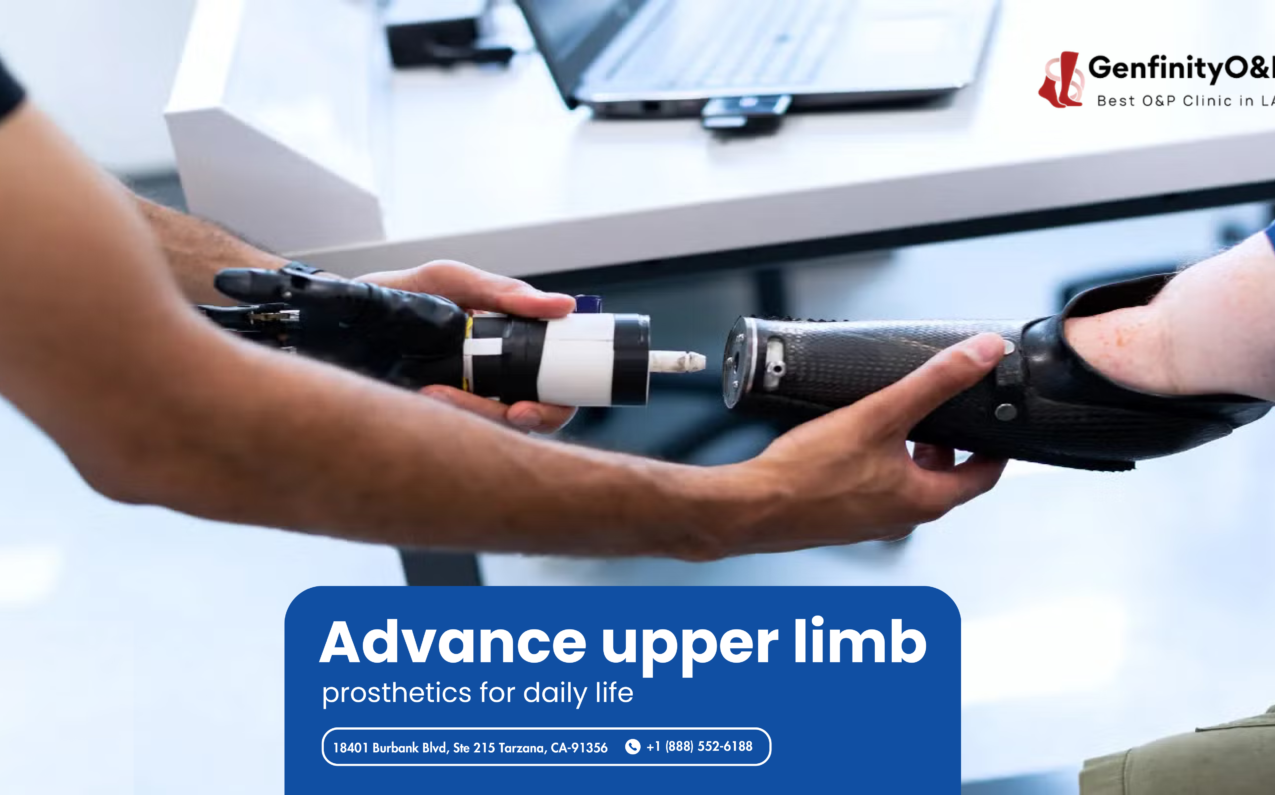 upper limb prosthetics