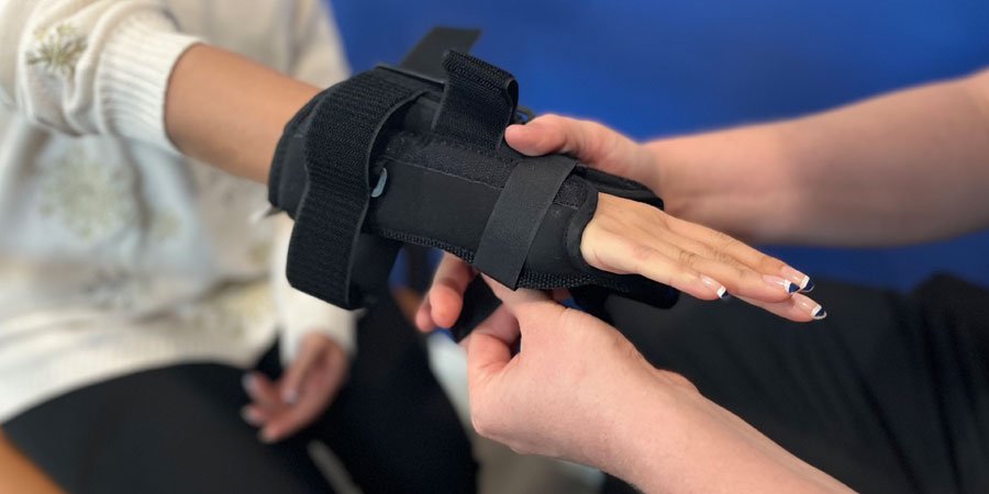 upper limb prosthetics