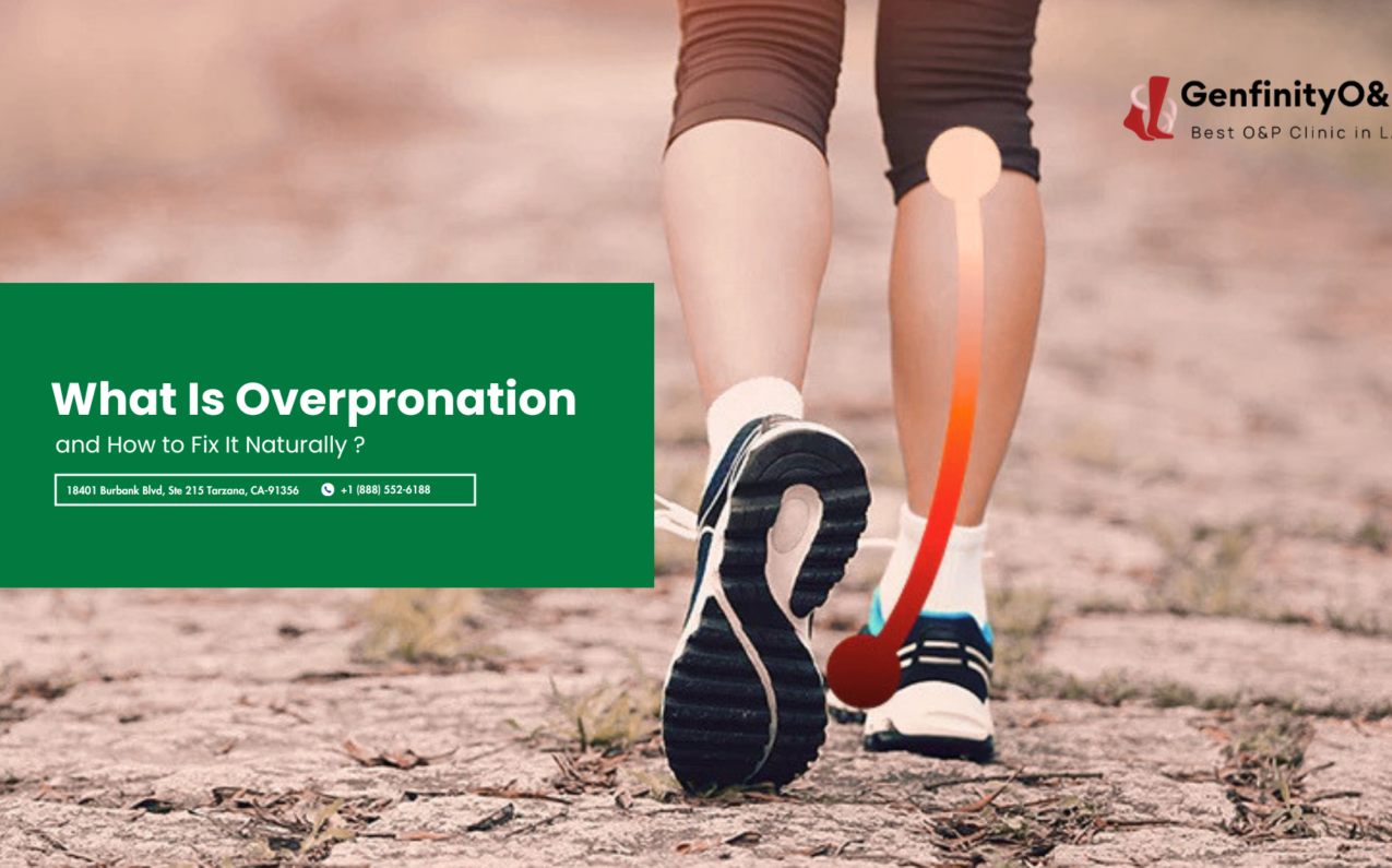 Overpronation